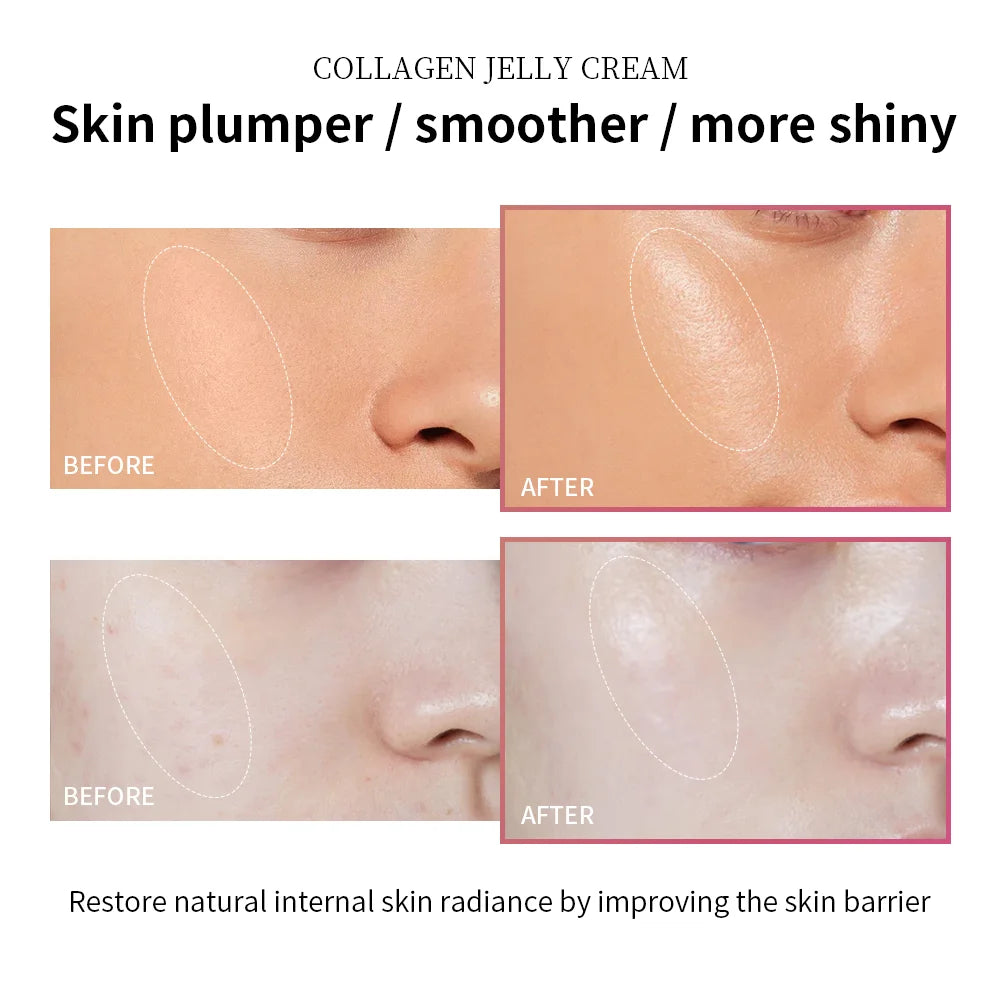 100ml Collagen Jelly Cream – Niacinamide Moisturizing Face Gel for Anti-Aging, Hydration & Firmness