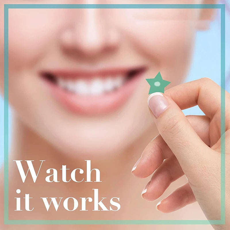 300/600/1200pcs Star-Shaped Acne Pimple Patches – Invisible Hydrocolloid Spot Stickers for All Skin Types
