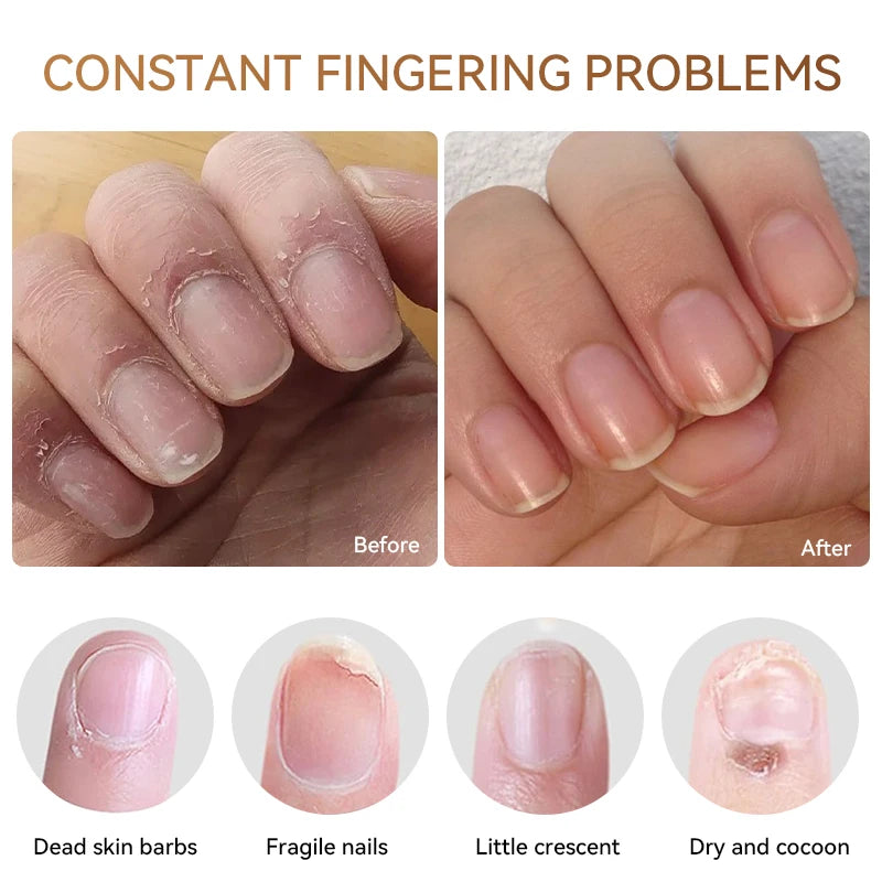 5ml Cuticle & Nail Nutrition Oil – Moisturizing Nail Treatment for Agnail and Skin Repair