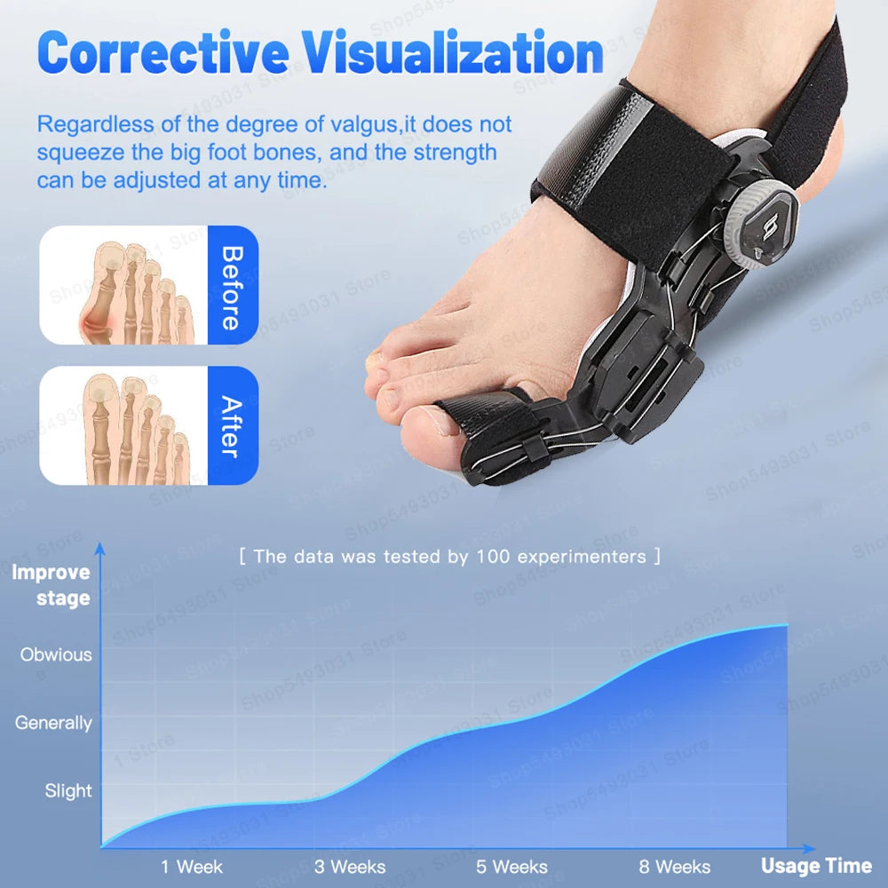 Adjustable Bunion Corrector – Hallux Valgus Toe Straightener with Rotating Knob, Toe Separator & Soft Silicone Pad