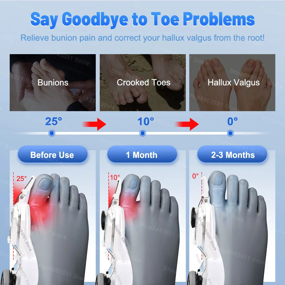 Adjustable Bunion Corrector – Hallux Valgus Toe Straightener with Rotating Knob, Toe Separator & Soft Silicone Pad